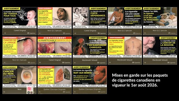 Des anticorps pourraient inhiber la lutte contre le cancer